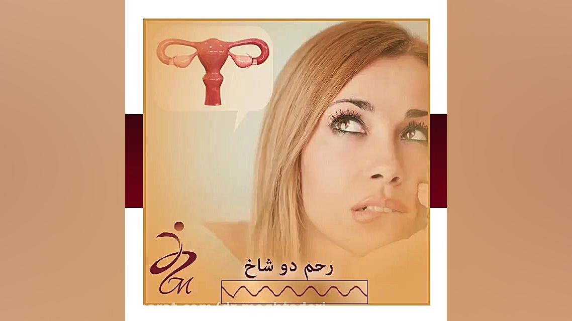 خطرات رحم دوشاخ را بشناسید