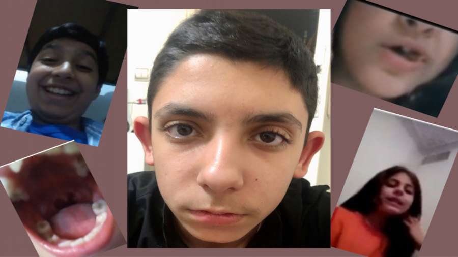 خل و چل های آپاراتی اوسکل به م...