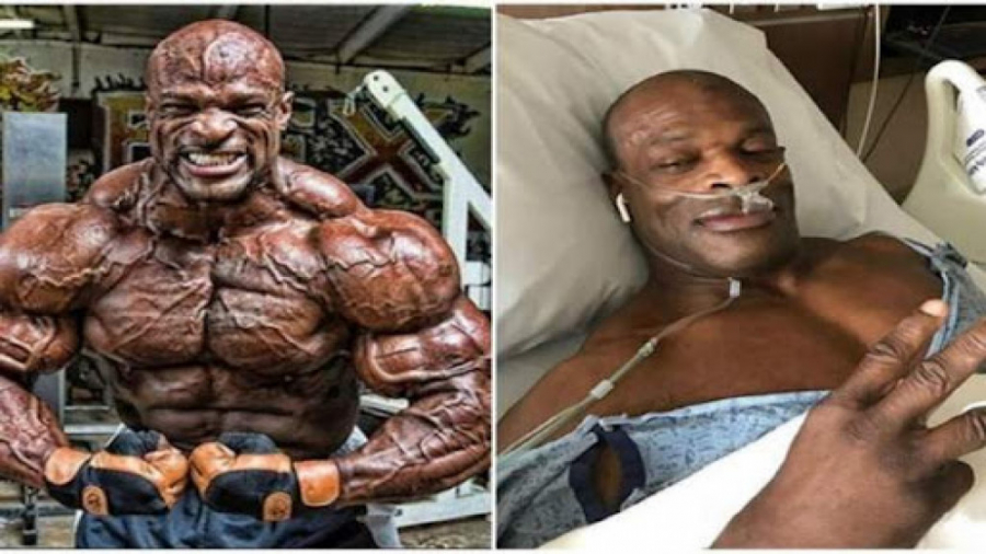 فیت ۱۸۲  بدنسازی بدون دارو امک...