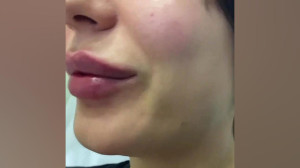 واکسن ویروس کرونا