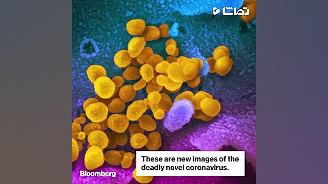 ویروس کرونا را از نزدیک ببینید