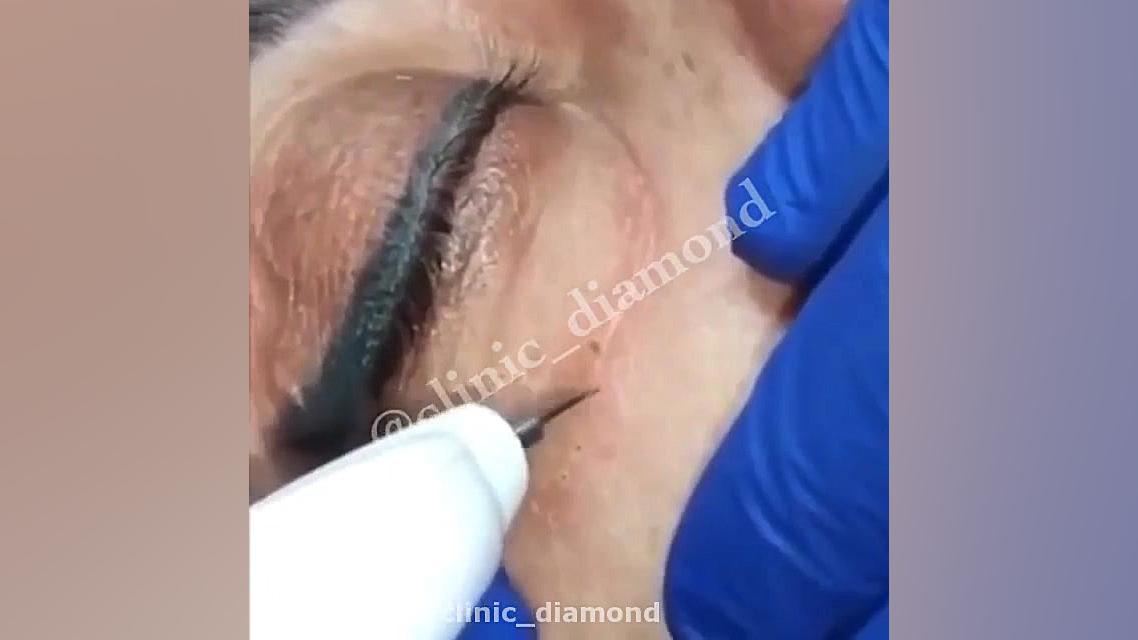 پلکسر پلک با قیمت بسیار مناسب...