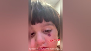 ترمیم زخم