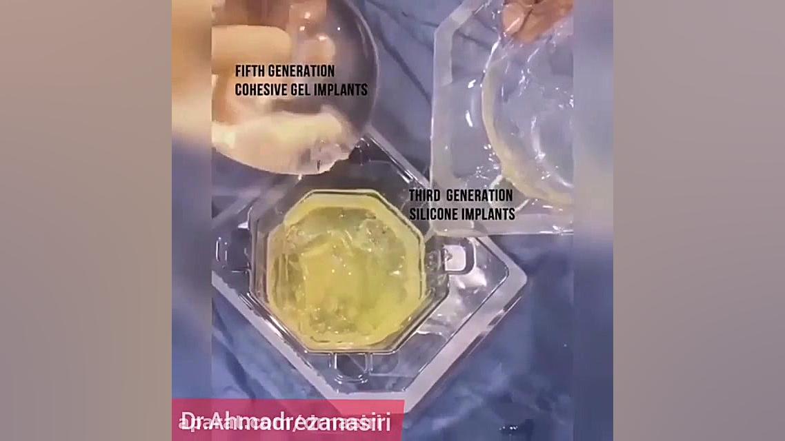 مقایسه پروتز سینه