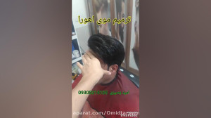 ترمیم مو پروتز مو کرمانشاه