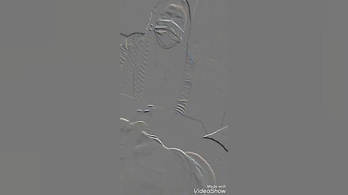 تفاوت سرفه کورونا با بیماری ها...