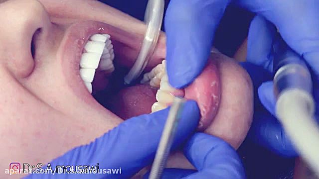 درمان زيبايي