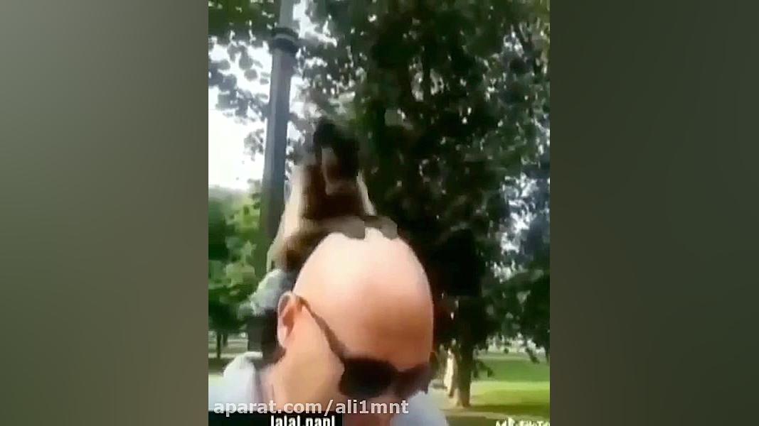 کچل ها در چه حالن