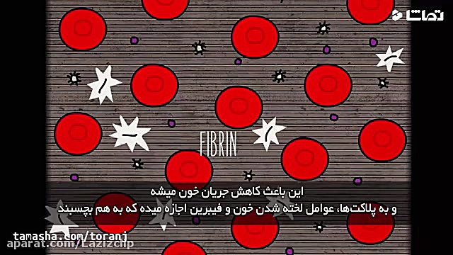 در هنگام سکته چه باید کرد؟