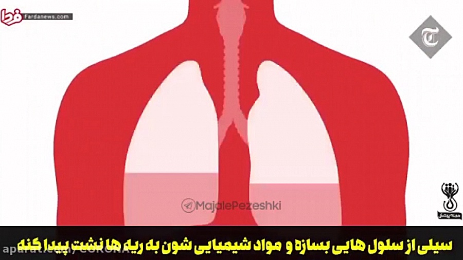 بلایی که کرونا سر ریه می&zwnj;...