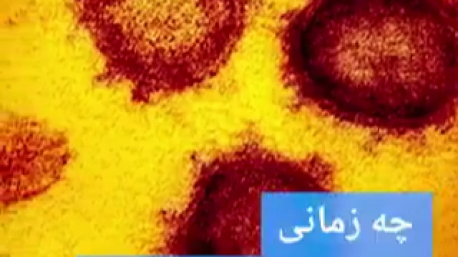 چه زمانی تست کرونا بدیم؟