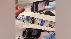 علائم بهبودی کرونا