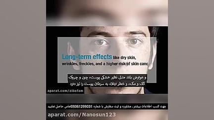 درمان پسوریازیس پوست سر با اکس...