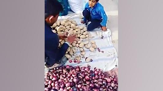 سوراخای سیب زمینی رو میگیرن، ب...