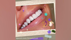 یک هفته بعد از انجام ونیر کامپ...