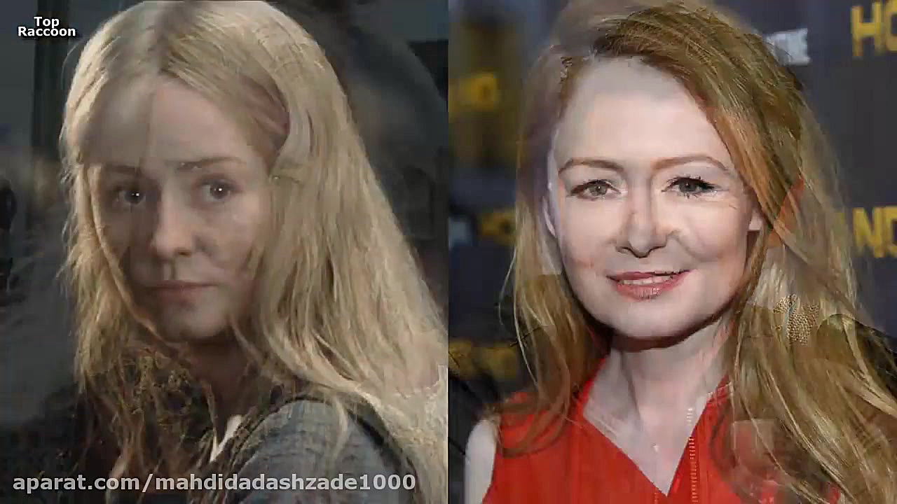 قبل و بعد بازیگران فیلم سینمای...