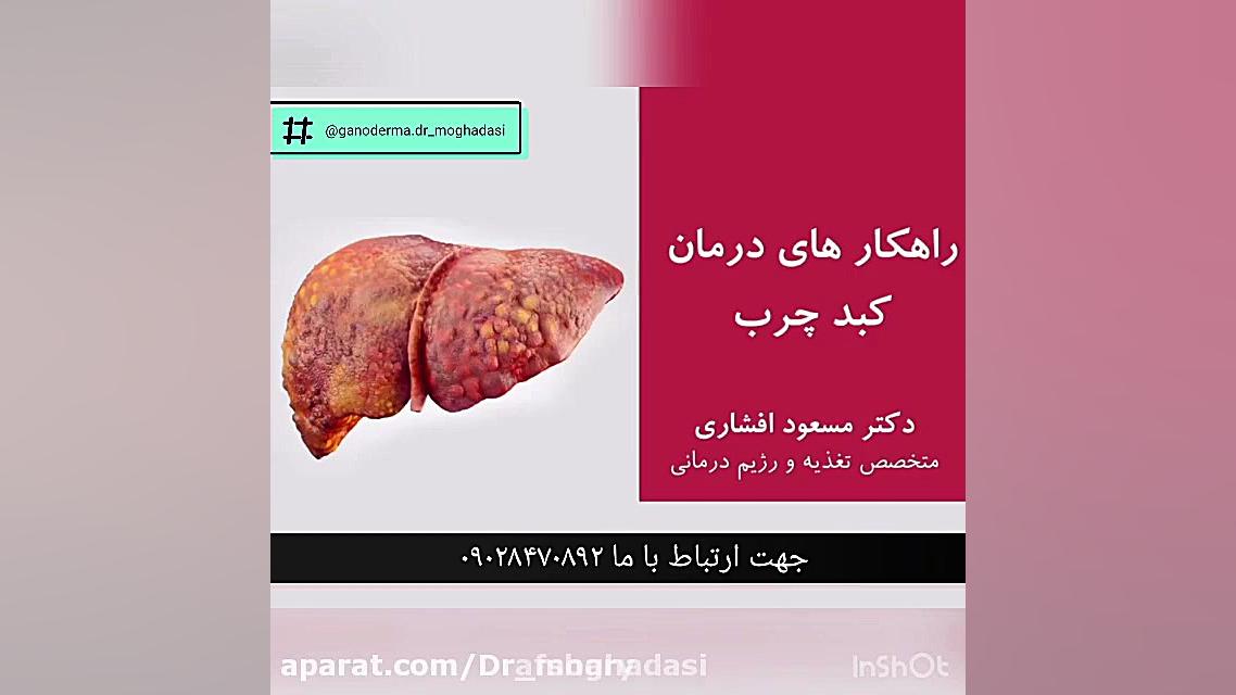 بررسی عوامل موثر در درمان کبد...