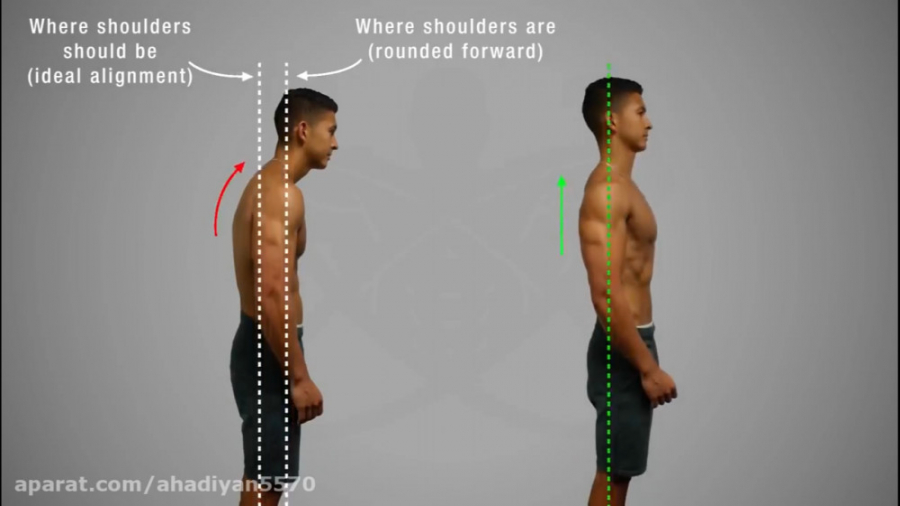 برطرف کردن گودی گردن با ورزش د...