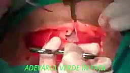 عمل زایمان