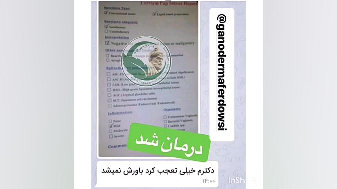 درمان زگیل تناسلی