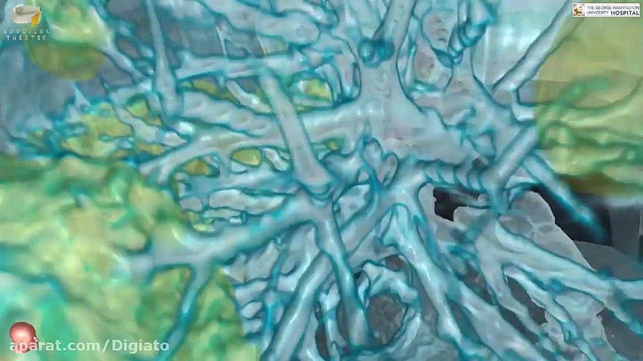 آنچه که ویروس کرونا بر سر ریه...