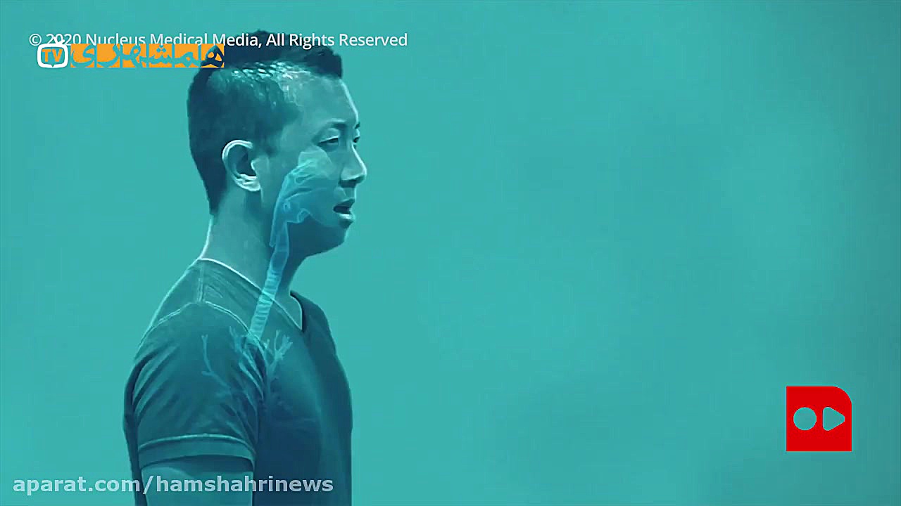 آیا فاوی پیراویر داروی قطعی کر...