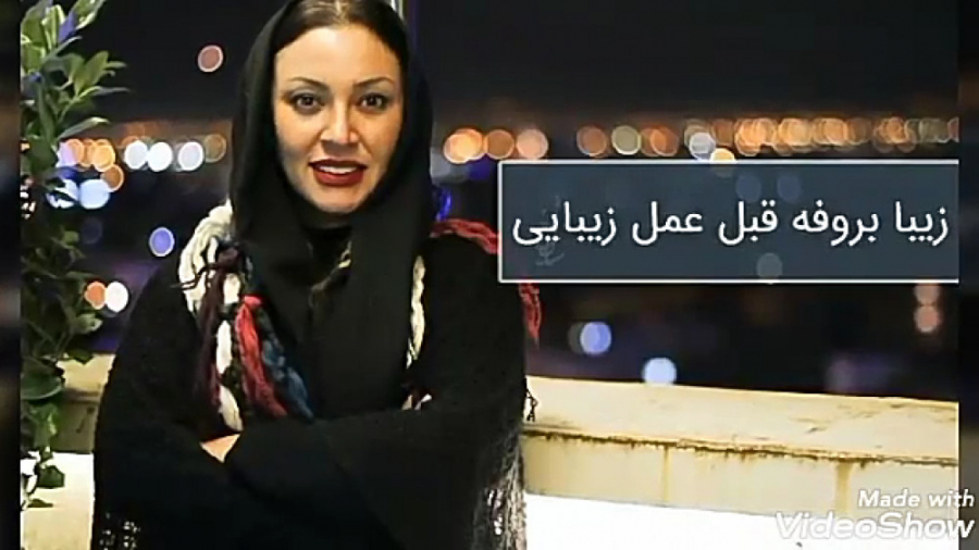 تصاویر زیبا بروفه قبل عمل زیبا...