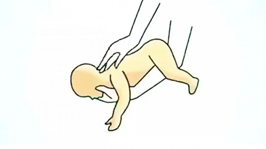 روش نجات کودک از خفگی