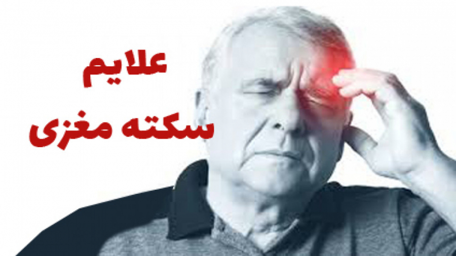 تشخیص سکته مغزی به زبان ساده