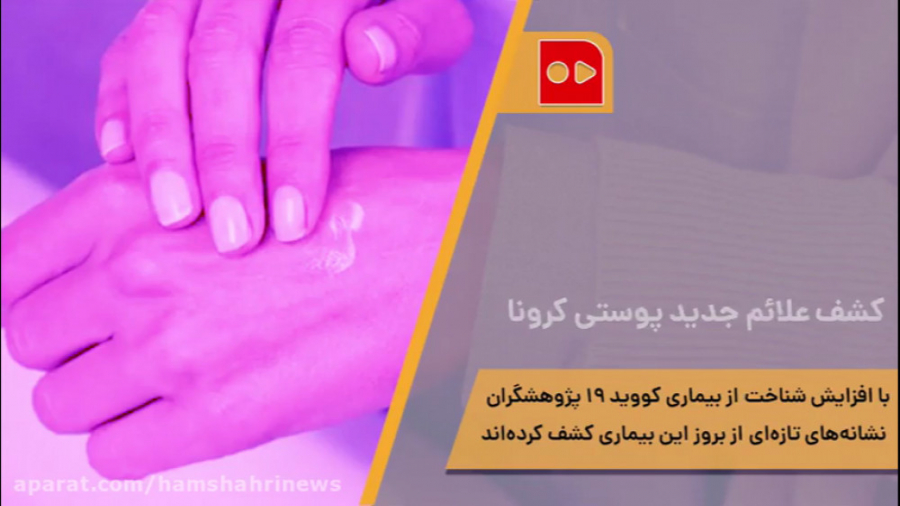 کشف علائم جدید پوستی کرونا