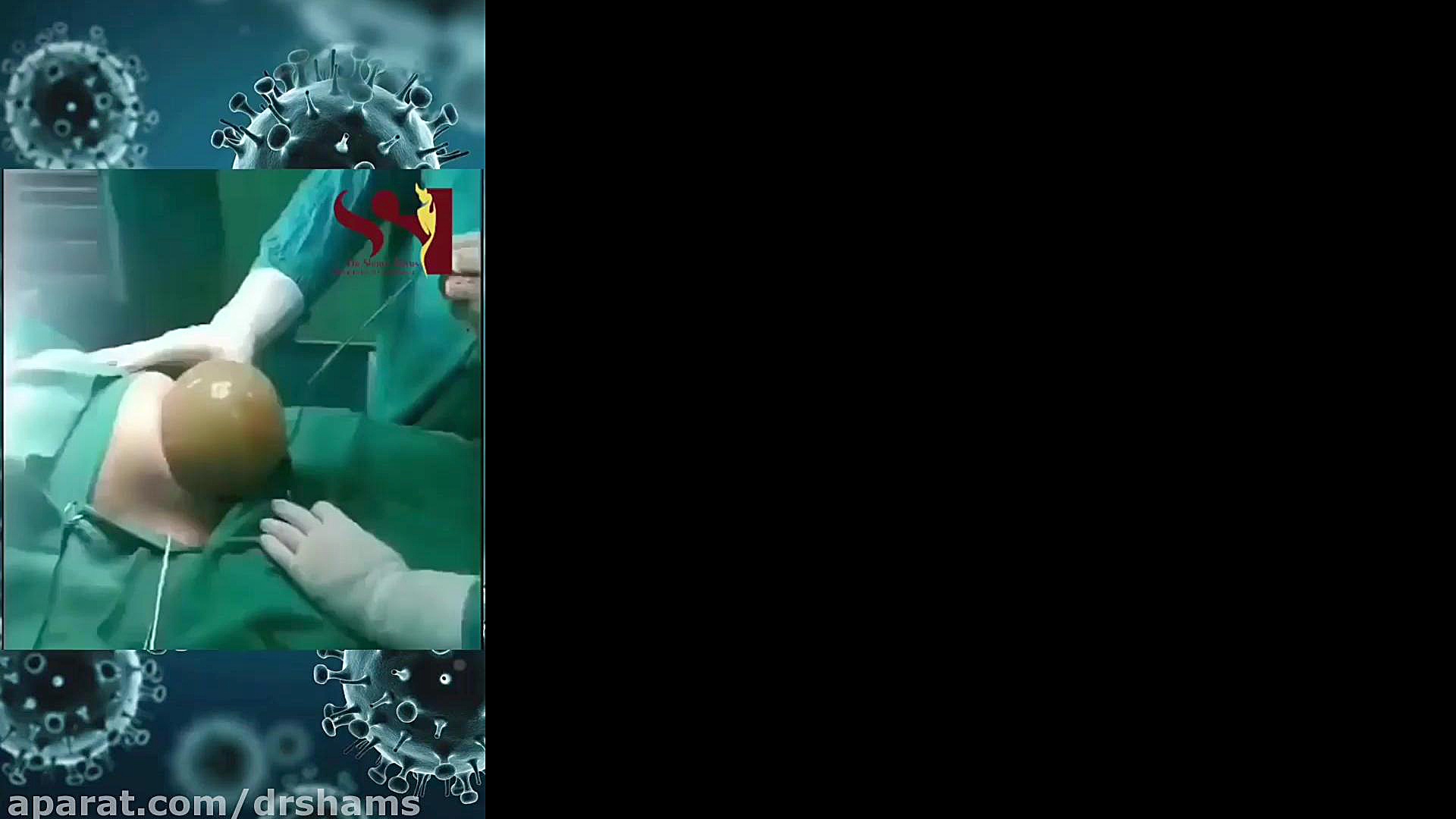 بارداری و ویروس کرونا