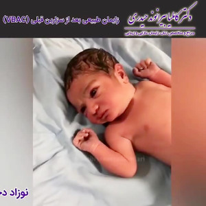 زایمان طبیعی بعد از سزارین | د...
