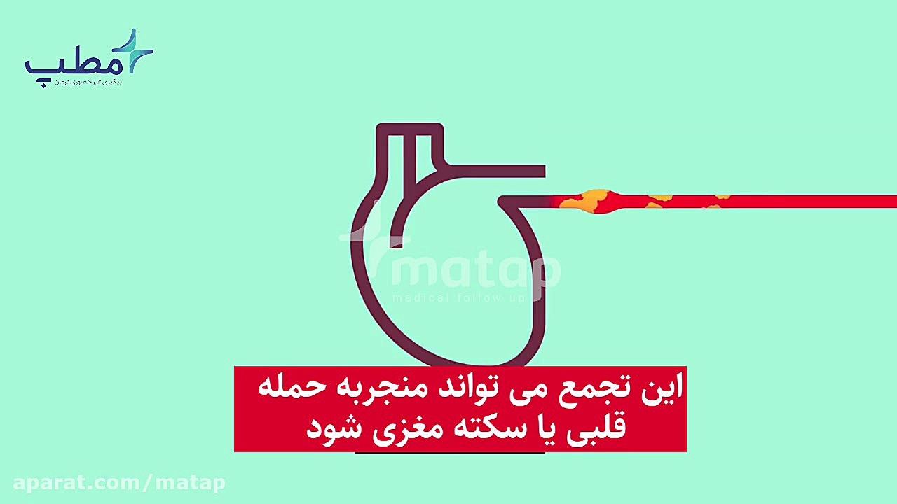 فشار خون بالا!