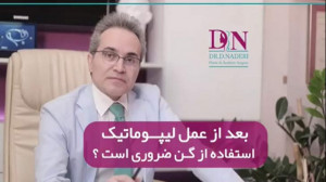 استفاده از گن بعد از عمل لیپوم...
