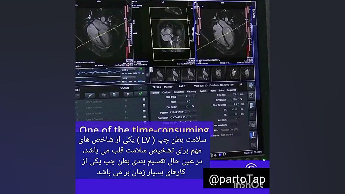 استفاده از هوش مصنوعی برای شکس...