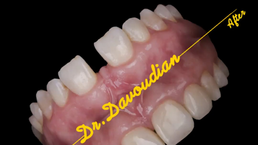 فرنوم و دیاستم | دکتر داودیان