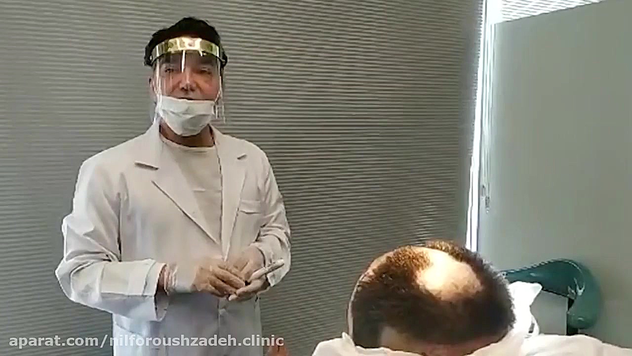 لایو کاشت مو