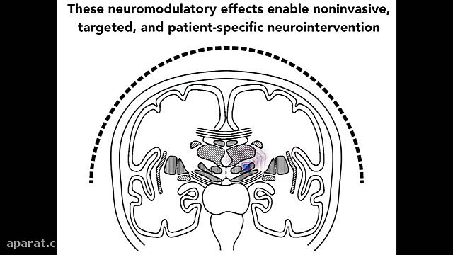 تحریک مغز میمون‌ها با امواج فر...