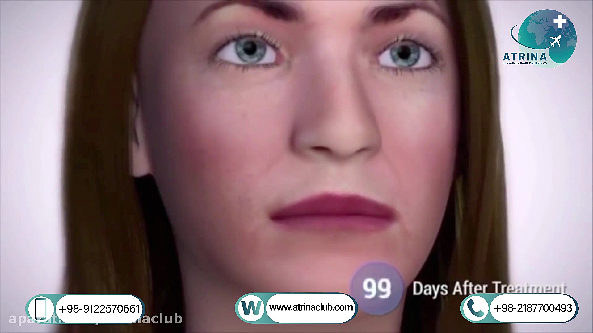  neck and double chin Haifu in...