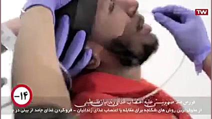  18 | فیلم حاوی تصاویر دلخراش...