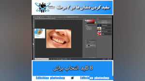 تکنیک سفید کردن دندانها در فتو...