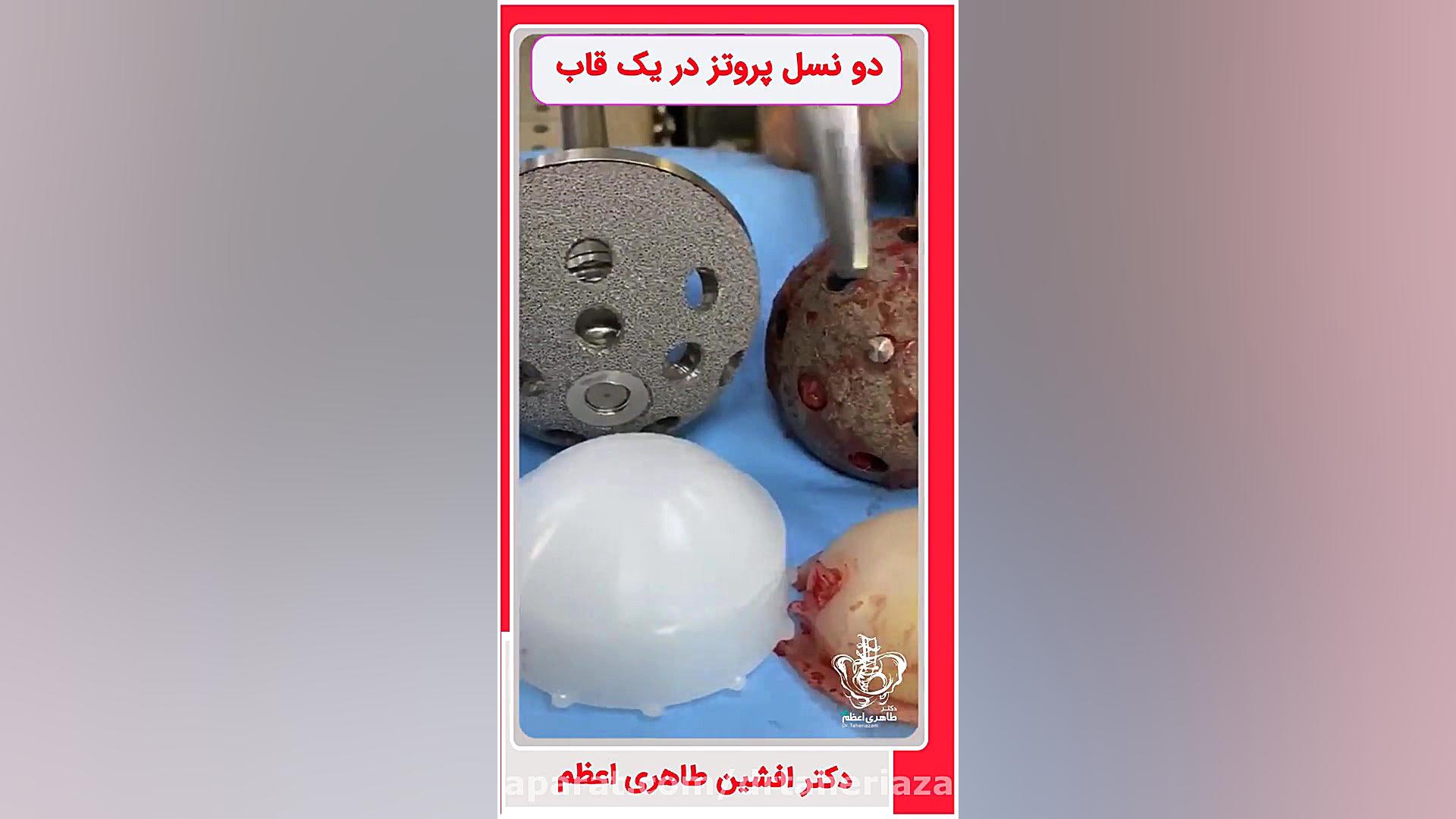 دو نسل پروتز در یک قاب  دکتر ا...