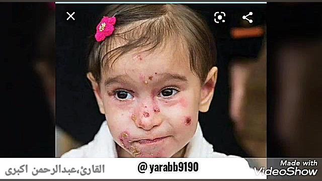 اللهم عافنی فی بدنی،،بصوت عبدا...