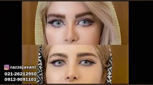 لیفت ابرو