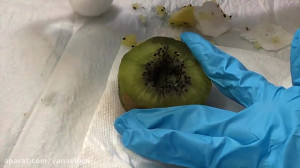 اسمر عمل جراحی روی کیوی !