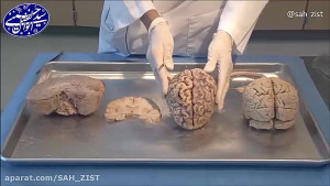 تشریح مغز ( زیر نویس )