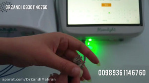 دیود آمریکایی، کوپلینگ عالی، ف...