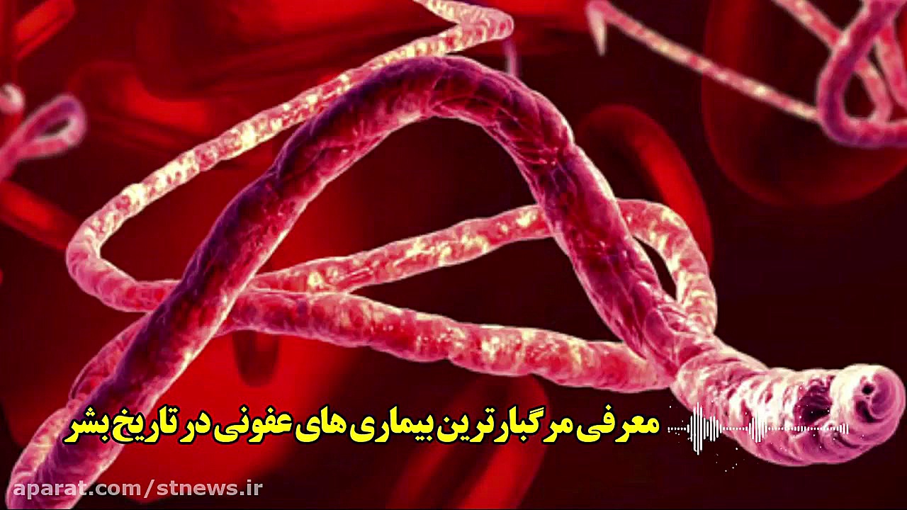 پادکست صوتی این هفته  بیماری ه...