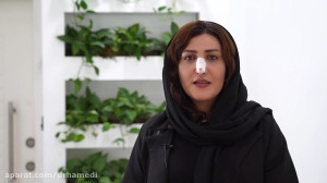 4 هفته بعد از عمل بینی با دکتر...