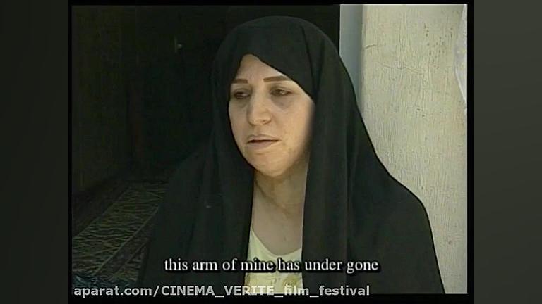 129  تنازع بقاع (آنونس)